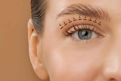 Chirurgia estetică a feței