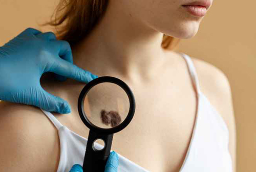 Chirurgie Mohs